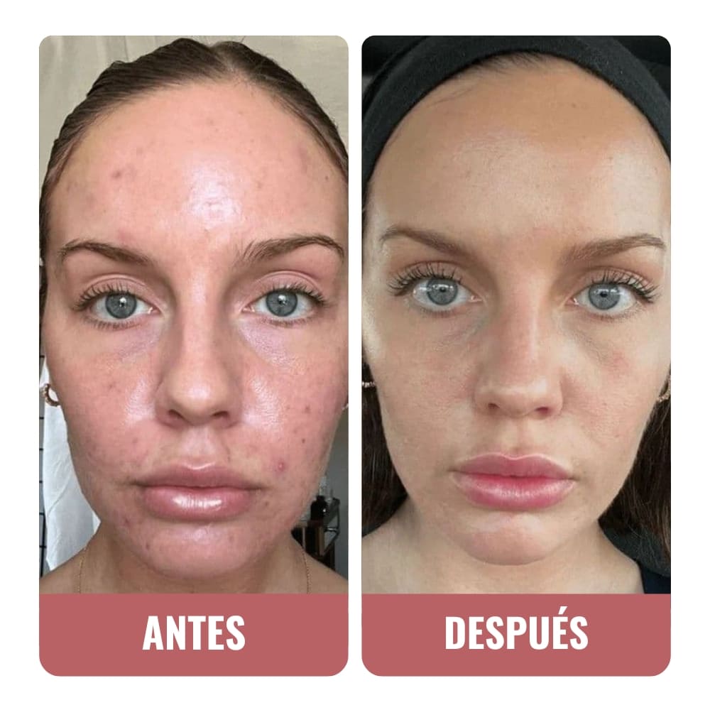 Efecto 