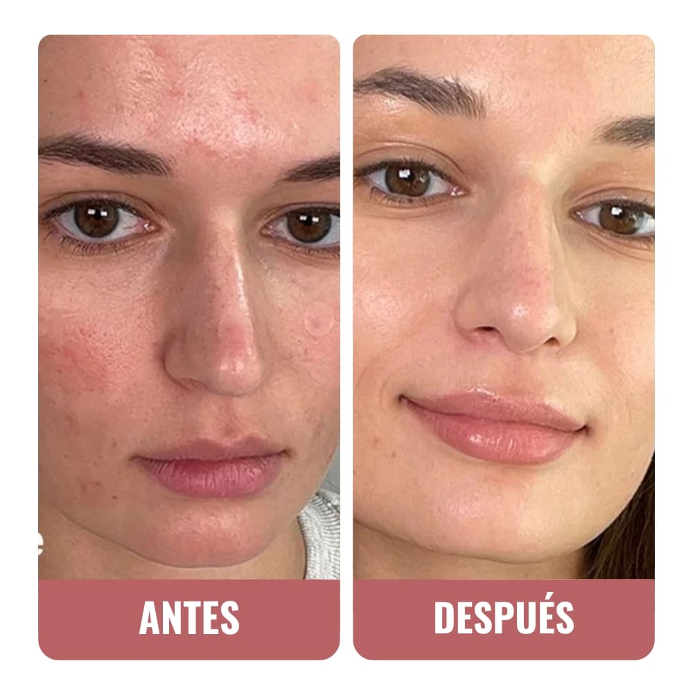 ¡Mi secreto para unas axilas y rodillas perfectas!