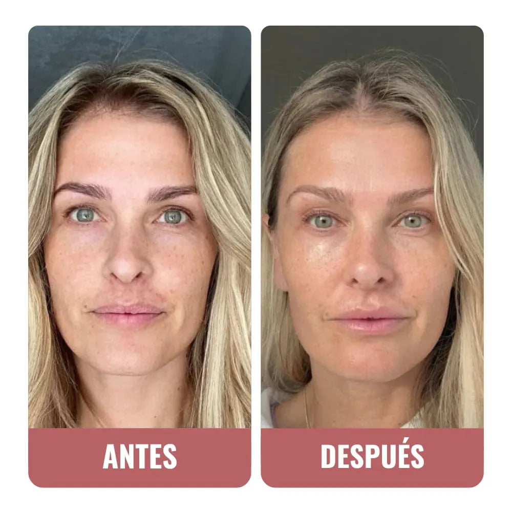 Seguro para mi piel sensible, ¡lo uso con Retinol!