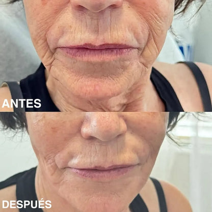 Bálsamo Coreano Antiarrugas con PDRN Wombea