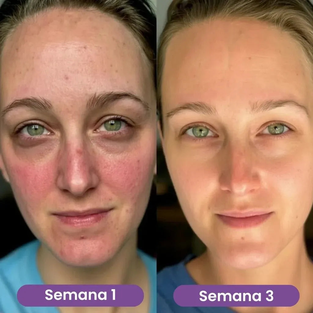 VoluFine | Sérum coreano de colágeno para piel madura