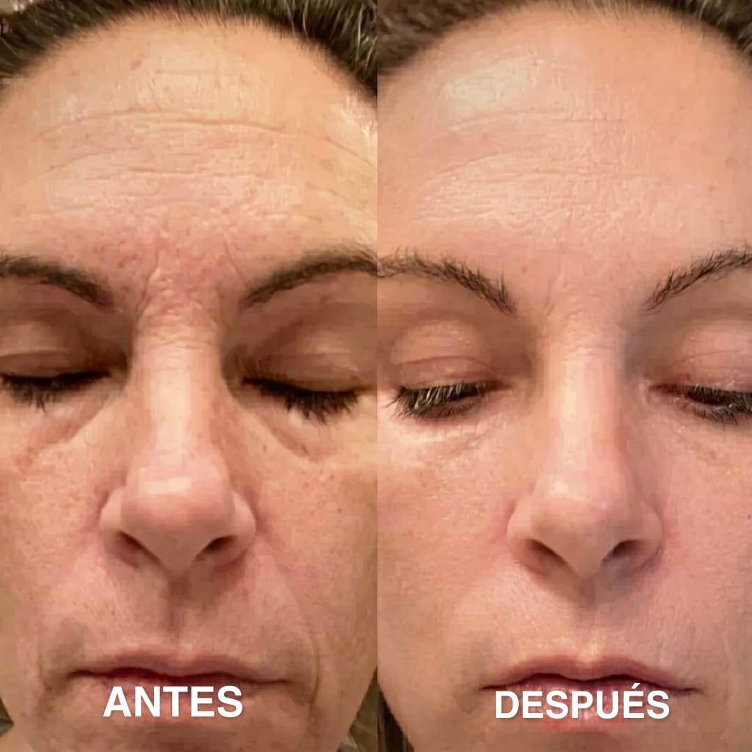 Bálsamo Coreano Antiarrugas con PDRN Wombea
