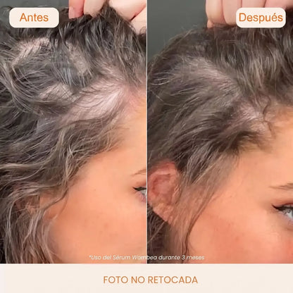 El sérum n.º 1 de Corea para el crecimiento del cabello
